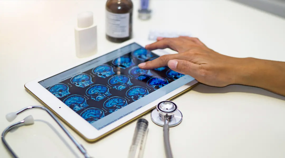 Close de um tablet com imagens de radiologia com uma mão pressionando a tela.